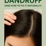 What Causes Dandruff (And How to Fix It Naturally for Good)